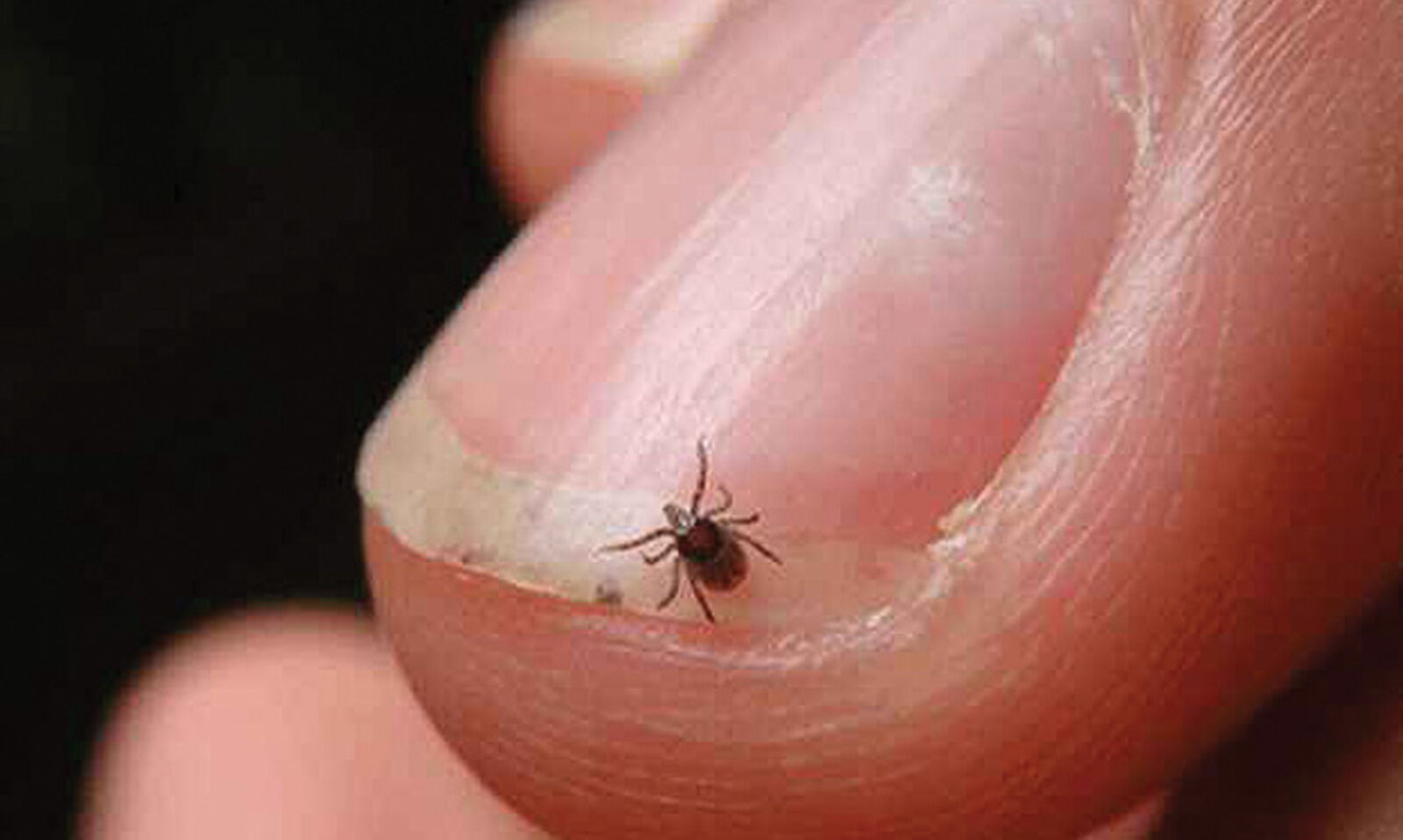 What is Scrub Typhus? Is it really life threatening?